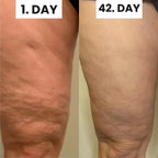 Wellness™ Cellulite Relief Kit